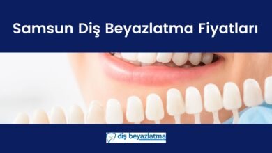 samsun diş beyazlatma fiyatları
